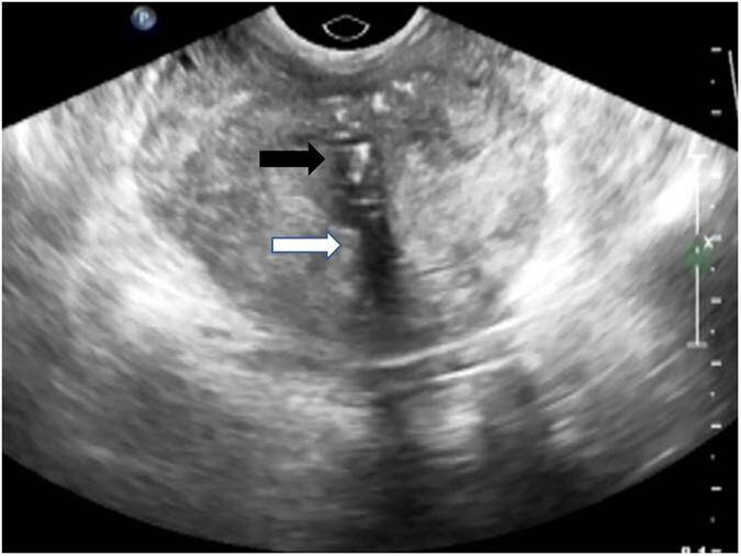 Advanced Prostate Imaging