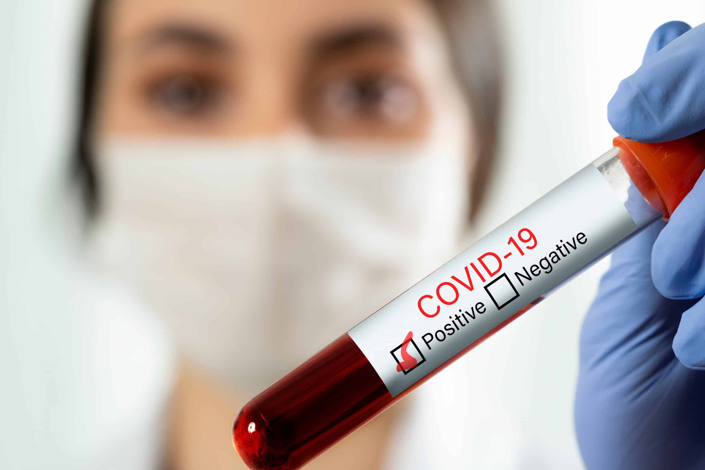 Doctor holding a blood test tube